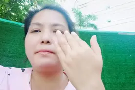 尿毒症生活：透析机器一直报警，下机称体重抽水不够，手肿成这样视频封面