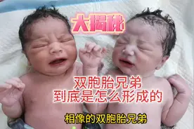 大揭秘 为什么双胞胎兄弟这么相像 但长大后性格迥异 原因在哪里视频封面