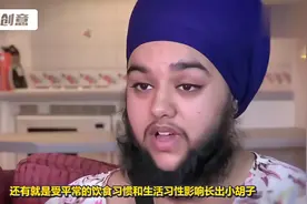 为什么有些女生嘴角都长黑黑的“胡子”？