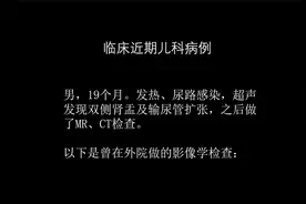 影像科容易忽略的病：膀胱输尿管反流,影像与诊断PPT视频封面