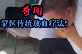 神秘“放血疗法”被称为千年藏医特色外疗法@中视频伙伴计划官号视频封面