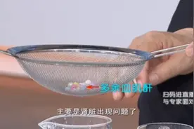 血肌酐与肾功能密切相关，血肌酐有什么作用？看完你就懂了视频封面
