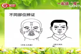 专家来了：专家分析脸上长痘痘的原因，这些不良习惯你有吗？