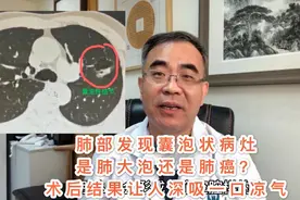 肺部发现囊泡状病灶，是肺大泡还是肺癌？术后感叹，幸好做了手术视频封面