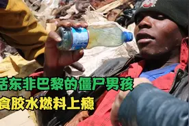 “东非巴黎”僵尸男孩，吸食胶水燃料上瘾，过着行尸走肉的生活视频封面