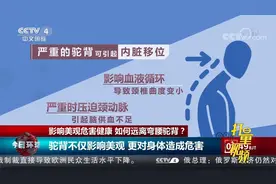 专家提醒：驼背不仅影响美观，更对身体造成危害|今日环球
