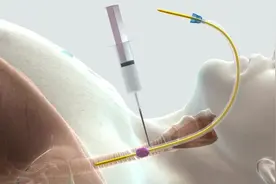 气管切开，是这么切的！ICU医生操作、麻醉科医生操作。。。