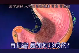医学演绎 人体的胃部健康 胃癌 胃糜烂 胃损害 是如何形成的？