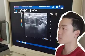 秋裤发现下颌有个小硬块，很担忧去医院做了检查，医生怎么说？视频封面