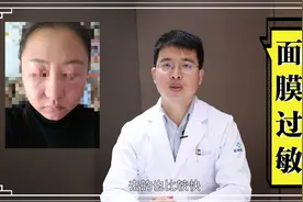 贴面膜之后面部红肿过敏该如何处理？皮肤科医生为你解答视频封面