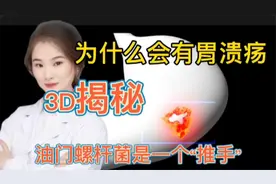 为什么人会患有胃溃疡 3D视频揭秘 原来幽门螺杆菌是主要“推手”