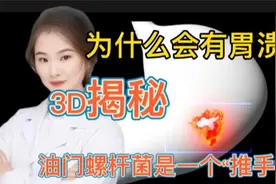 为什么人会患有胃溃疡 3D视频揭秘 原来幽门螺杆菌是主要“推手”