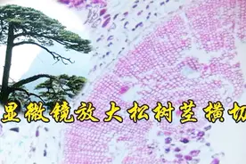 松树茎横切显微镜下放大400倍，画面太有美感，美如石榴果实视频封面