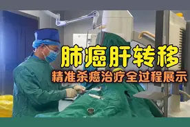 肺癌肝转移，动脉灌注化疗全过程：药直接送到肿瘤里，精准杀癌！视频封面