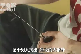 500年前的中医穿越到现代，一手大钢针针灸惊呆众人视频封面