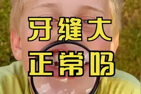 宝宝牙缝越来越大，可能是件好事情！牙齿缝隙越来越大是怎么回事视频封面