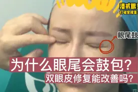双眼皮修复潘贰博士科普：为什么眼尾有包？修复手术能改善吗？视频封面