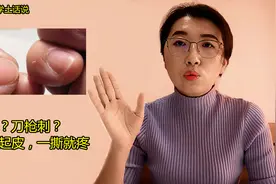手指甲周边总起皮，一撕就出血，做好保湿措施预防刀枪刺视频封面