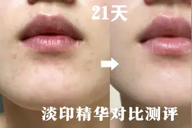 21天淡印教科书！先消炎再抗氧后抑黑！这思路不服不行！视频封面