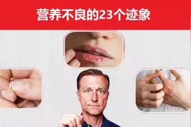 这23个迹象，是身体缺乏营养的表现，如何改善？视频封面