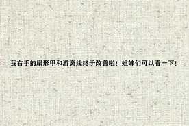 我右手的扇形甲和游离线终于改善啦！姐妹们可以看一下！【转载】视频封面