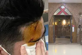 小伙玩密室逃脱，遭“NPC”追逐撞上硬物，导致额头被缝11针视频封面