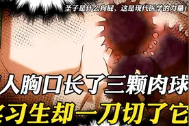 男人胸口长三颗肉球，每天都在迅速变大，不料实习生直接把它切了视频封面