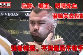 扇耳光大赛脸被扇变形，对手泪腺失去控制，牙套也被染红视频封面