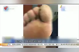10岁男孩游泳后脚底长肉球？医生：感染HPV病毒视频封面