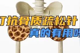 骨密度-4，医生建议打抗骨质疏松针，请问这种针真的有用吗？视频封面
