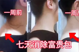一周见效，这样锻炼富贵包，一个月富贵包就没有了视频封面