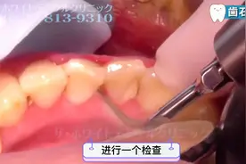 28岁日本女性，因为洗牙导致呕吐反应，医生决定麻醉下进行视频封面