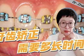 牙齿矫正一般需要多长时间？1年、2年，还是3年？视频封面