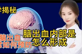 医学揭秘 为什么会出现脑出血 日常如何预防和处理 脑出血的症状视频封面