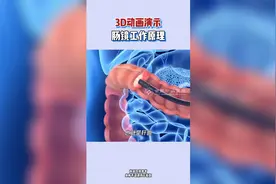 合肥中山医院胃肠科普-3D动画演示肠镜工作原理-合肥肠镜全过程