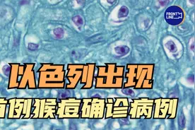 以色列出现首例猴痘确诊病例：从西欧地区返回视频封面