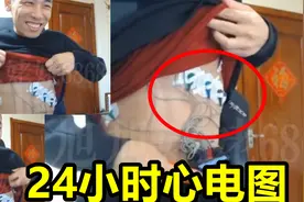 宝哥身体不舒服，结果医院给按了个24小时心电图！宝哥：都包浆了视频封面