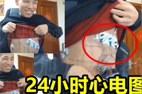 宝哥身体不舒服，结果医院给按了个24小时心电图！宝哥：都包浆了视频封面