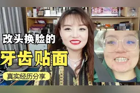 我终于敢自信的笑了！牙缝大牙黄变整齐大白牙！牙齿贴面经验分享