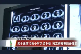 男子连续10余小时久坐不动  突发肺栓塞险丢性命视频封面