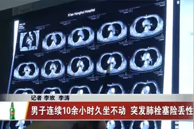 男子连续10余小时久坐不动  突发肺栓塞险丢性命视频封面