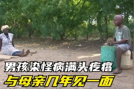 生活在艾滋病最多的国家，男孩染怪病满头疙瘩，与母亲几年见一面视频封面