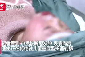 情况紧急!贵州两岁宝宝喝下管道疏通剂，嘴唇发肿！父母被吓晕视频封面