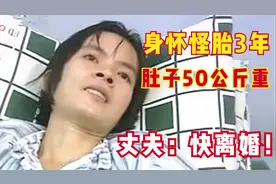 29岁女子怀怪胎，3年还没生，50公斤巨腹让医生都害怕，纪录片视频封面