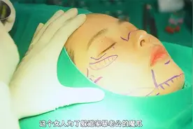 为躲避家Bao老公的魔爪，选择整容，结果医生的做法让人大吃一惊