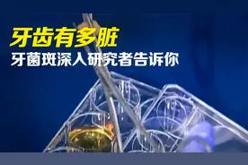 牙齿有多脏！听听科学家们怎么说，及时护理口腔清洁的重要性！视频封面