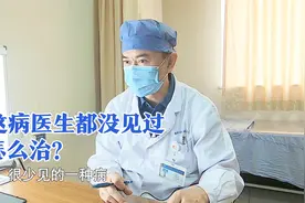 身体各处淋巴结增大罕见疾病，医生称没见过，家属：这是癌吗？视频封面