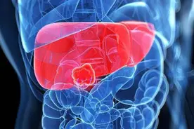 肝癌手术后，经过多长时间患者才可能会恢复？视频封面