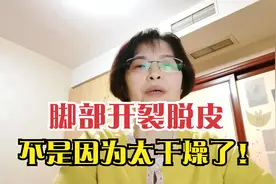 脚部开裂脱皮，是因为皮肤太干燥？这几种足癣类型不要忽视了视频封面