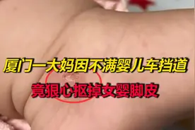 厦门一大妈因不满婴儿车挡道，竟狠心抠掉女婴脚皮，已被警方拘留视频封面